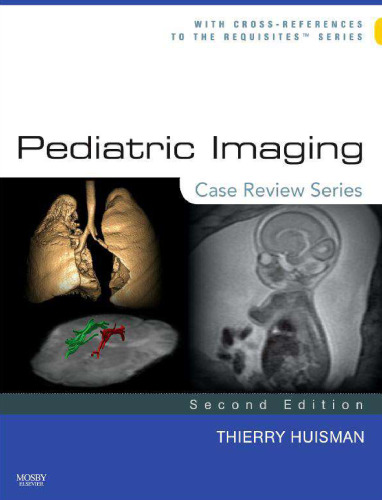 Pediatric Imaging:Case Review Series