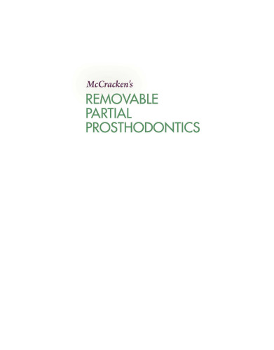 Mc: Cracken's Removable Partial Prosthodontics