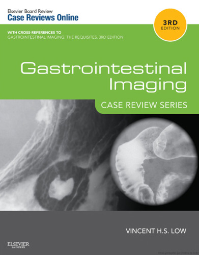 Gastrointestinal Imaging: Case Review Series: Case Review Series