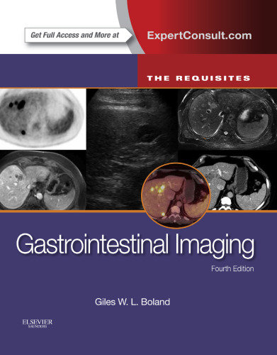 Gastrointestinal Imaging: The Requisites