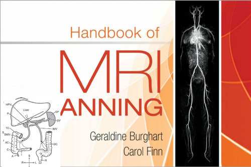 Handbook of MRI Scanning.