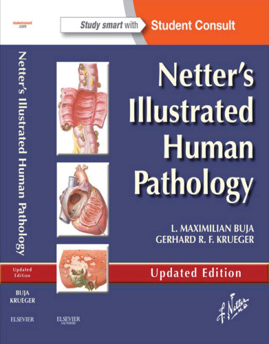 Netter's Illustrated Human Pathology Updated Edition
