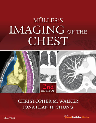 Muller's Imaging of the Chest E-Book : Series