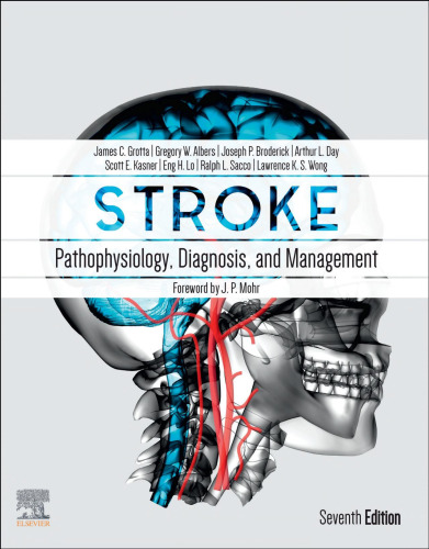 Stroke E-Book: Pathophysiology, Diagnosis, and Management