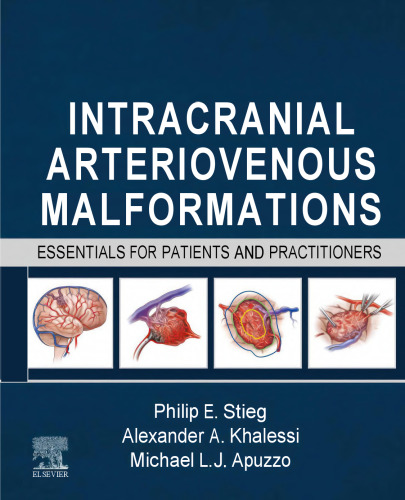 Intracranial Arteriovenous Malformations: Essentials for Patients and Practitioners