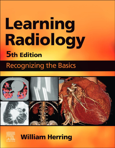 LEARNING RADIOLOGY,