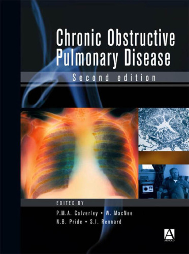 Chronic obstructive pulmonary disease