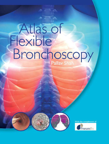 Atlas of flexible bronchoscopy