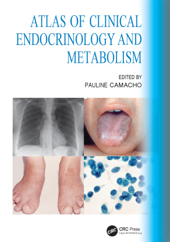 Atlas of Clinical Endocrinology and Metabolism (Feb 16, 2024)_(0367608359)_(CRC Press)