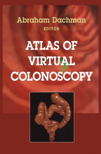 Atlas of Virtual Colonoscopy
