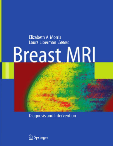 Breast MRI: Diagnosis and Intervention