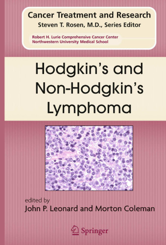 Hodgkin’s and Non-Hodgkin’s Lymphoma