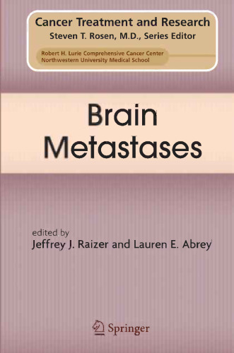 Brain Metastases