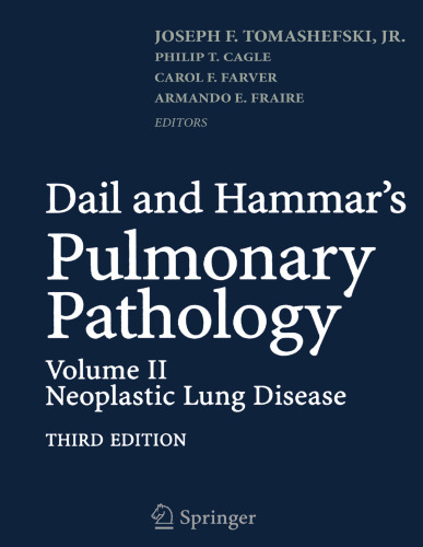 Dail and Hammar’s Pulmonary Pathology: Volume II: Neoplastic Lung Disease