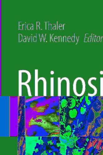 Rhinosinusitis: A Guide for Diagnosis and Management
