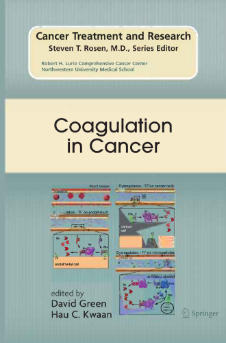 Coagulation in Cancer