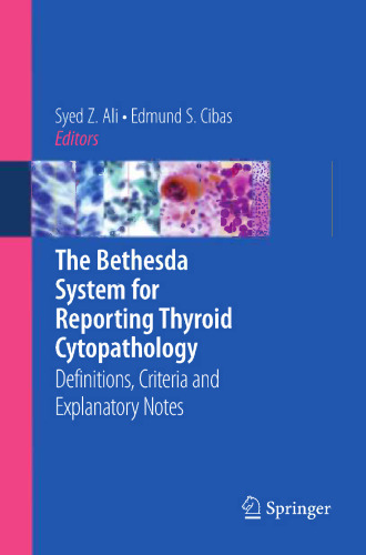 The Bethesda System for Reporting Thyroid Cytopathology: Definitions, Criteria and Explanatory Notes