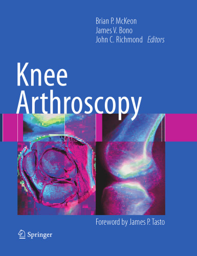 Knee Arthroscopy