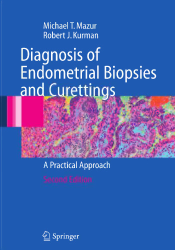 Diagnosis of Endometrial Biopsies and Curettings: A Practical Approach