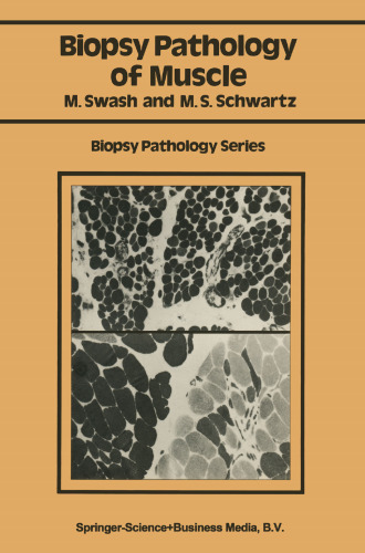Biopsy Pathology of Muscle