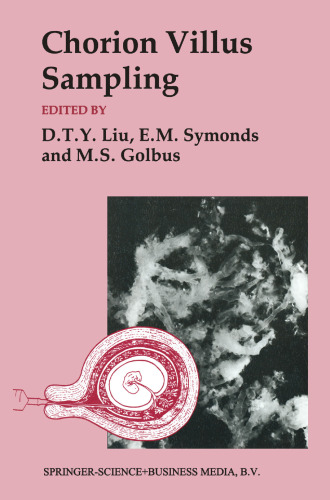 Chorion Villus: Sampling