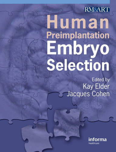 Human Preimplantation Embryo Selection