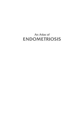 Atlas of Endometriosis
