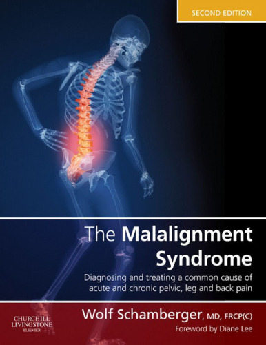 The Malalignment Syndrome Diagnosing and treating a common cause