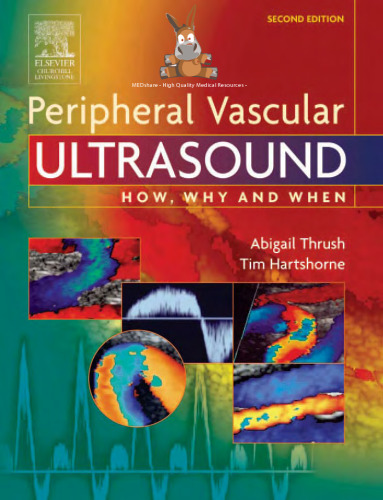 Peripheral vascular ultrasound: how, why, and when