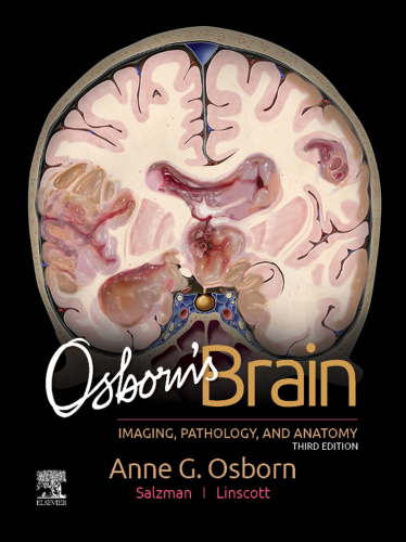 Osborn's Brain: Imaging, Pathology, and Anatomy