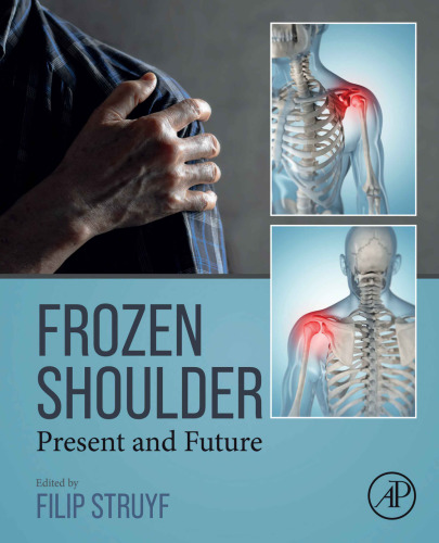 Frozen Shoulder: Present and Future
