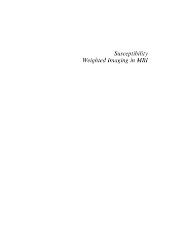 Susceptibility Weighted Imaging in MRI: Basic Concepts and Clinical Applications