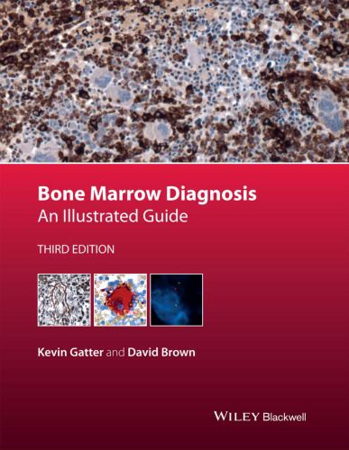 Bone marrow diagnosis : an illustrated guide
