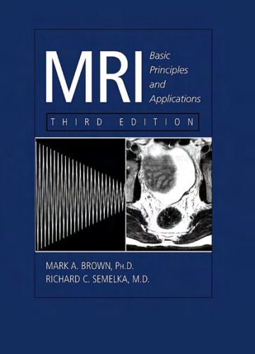MRI: basic principles and applications