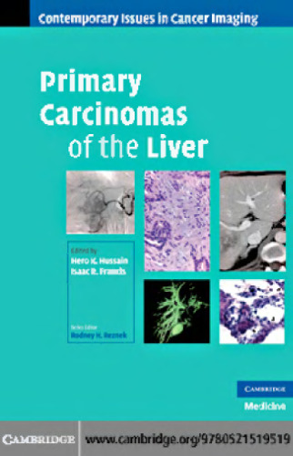 Primary Carcinomas of the Liver ()