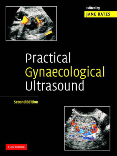 Practical Gynaecological Ultrasound