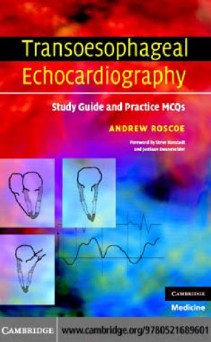 Transoesophageal Echocardiography: Study Guide and Practice MCQs
