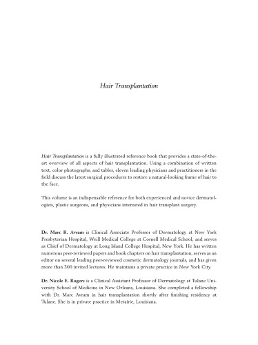 Hair Transplantation