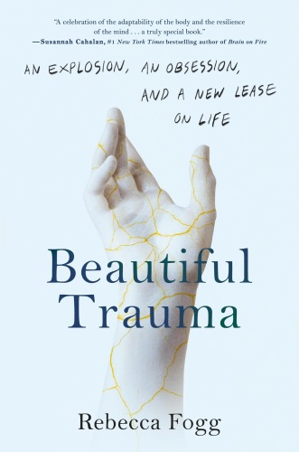 Beautiful Trauma : An Explosion, an Obsession, and a New Lease on Life