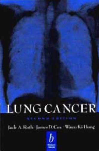 Lung Cancer Second edition