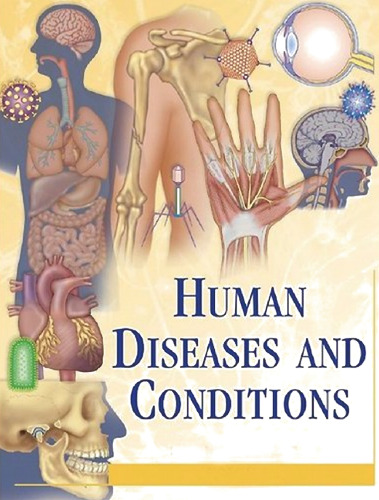 Human Diseases and Conditions