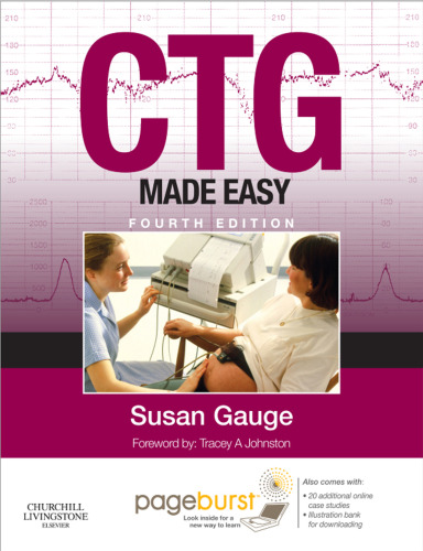 CTG made easy