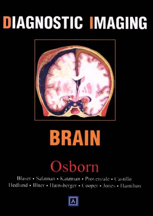 Diagnostic Imaging Brain
