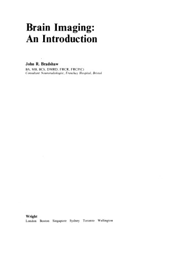 Brain Imaging. An Introduction