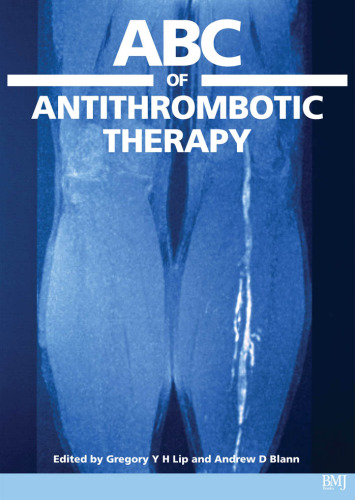 ABC of Antithrombotic