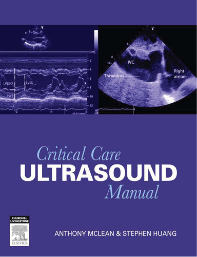 Critical Care Ultrasound Manual