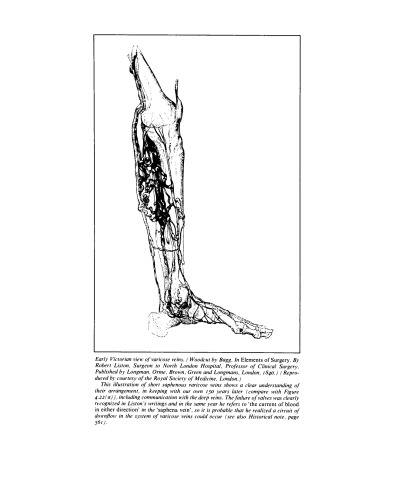 Varicose Veins and Related Disorders