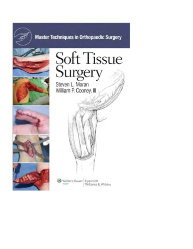 Master Techniques In Orthopaedic Surgery Soft Tissue Surgery