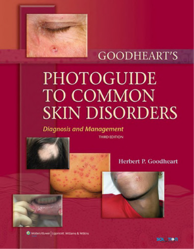 Goodheart’s Photoguide to Common Skin Disorders: Diagnosis and Management