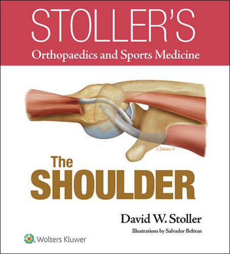 Stoller's atlas of orthopaedics and sports medicine
